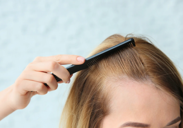 cheveux clairsemés femme